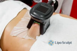 Does Fat Freezing At Home Work? 3 Fat freezing at home from Lipo Sculpt West Midlands